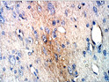 Immunohistochemistry with Anti-PRKDC Antibody (STJ500781) at 1:50 dilution in Buffer. DAB (brown) staining and Haematoxylin QS (blue) counterstain. 40X magnification. FFPE section.