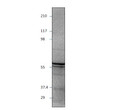 Western blot with Anti-E2F1 Antibody (STJ500810) with peptide on at 1:500 dilution in buffer.