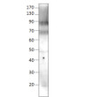 Western blot with Anti-GGCX Antibody (STJ501151) at 1:500 dilution in buffer.
