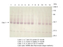 Western blot with Anti-SLC2A1 Antibody (STJ501193) of Rat brain at 1:2000 dilution in buffer on a 10% SDS gel.