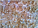 Immunohistochemistry of baboon liver with Anti-Isocitrate dehydrogenase primary antibody (STJ501386) at 1:50 dilution in Buffer. Section was treated with DAB and Haematoxylin stain. Magnification is at 40X.