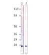 Western blot with Anti-IL23A Antibody (STJ501441) with peptide on at 1:500 dilution in buffer.