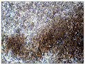 Immunohistochemistry of baboon spleen with Anti-LILRB3 primary antibody (STJ501604) at 1:100 dilution in Buffer. Section was treated with DAB and Haematoxylin stain. Magnification is at 40X.