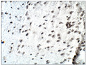 Immunohistochemistry of rat brain with Anti-D4S234E primary antibody (STJ501972) at 1:50 dilution in Buffer. Section was treated with DAB and Haematoxylin stain. Magnification is at 40X.