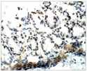 Immunohistochemistry of mouse Colon with Anti-HRAS primary antibody (STJ502035) at 1:100 dilution in Buffer. Section was treated with DAB and Haematoxylin stain. Magnification is at 20X.