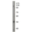 Western blot with Anti-PAR2 Antibody (STJ502113) with PAR2 peptide on at 1:500 dilution in buffer.