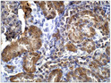 Immunohistochemistry of mouse kidney with Anti-PMS2 primary antibody (STJ502561) at 1:50 dilution in Buffer. Section was treated with DAB and Haematoxylin stain. Magnification is at 40X.