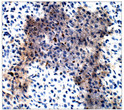 Immunohistochemistry of rat Ovary with Anti-PODXL primary antibody (STJ502574) at 1:100 dilution in Buffer. Section was treated with DAB and Haematoxylin stain. Magnification is at 40X.