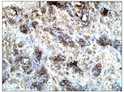 Immunohistochemistry of human tissue with Anti-PRL primary antibody (STJ502655) at 1:100 dilution in Buffer. Section was treated with DAB and Haematoxylin stain. Magnification is at 40X.
