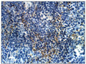 Immunohistochemistry of mouse spleen with Anti-PTPD1 primary antibody (STJ502717) at 1:50 dilution in Buffer. Section was treated with DAB and Haematoxylin stain. Magnification is at 40X.