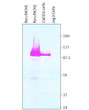 Western blot with Anti-RICH2 Antibody (STJ502780) with 1) Recombinant RICH1, 2) Recombinant RICH2, 3) CaCO2 cells, 4) Jeg3 cells. Antibody at 1:500 dilution in buffer.