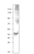 Western blot with Anti-RUNX3 Antibody (STJ502840) with RUNX3 peptide. Antibody at 1:500 dilution in buffer.