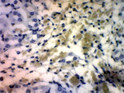 Immunohistochemistry of mouse kidney with Anti-Soluble Adenylate Cyclase 1 primary antibody (STJ502860) at 1:50 dilution in Buffer. Section was counterstained with Haematoxylin stain. Magnification is at 20X. Immunohistochemistry of mouse kidney with Anti-Soluble Adenylate Cyclase 1 primary antibody (STJ502860) at 1:50 dilution in Buffer. Section was counterstained with Haematoxylin stain. Magnification is at 20X.