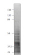 Western blot with Anti-SIRT2 Antibody (STJ503032) with SIR2 peptide. Antibody at 1:500 dilution in buffer.