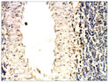 Immunohistochemistry of baboon spleen with Anti-SOCS1 primary antibody (STJ503077) at 1:100 dilution in buffer. Section was treated with DAB and Haematoxylin stain. Magnification is at 40X.