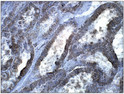 Immunohistochemistry of baboon kidney with Anti-STRADA primary antibody (STJ503155) at 1:100 dilution in Buffer. Section was treated with DAB and Haematoxylin stain. Magnification is at 40X. Immunohistochemistry of baboon kidney with Anti-STRADA primary antibody (STJ503155) at 1:100 dilution in Buffer. Section was treated with DAB and Haematoxylin stain. Magnification is at 40X.