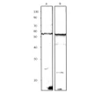 Western blot with Anti-SDC1 Antibody (STJ503191) with SYND1 peptide (A) on T47D cells (B). Antibody at 1:500 dilution in buffer.