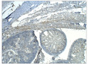 Immunohistochemistry of mouse tissue with Anti-TGM1 primary antibody (STJ503240) at 1:50 dilution in Buffer. Section was treated with DAB and Haematoxylin stain. Magnification is at 5X.