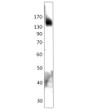 Western blot with Anti-TNIK Antibody (STJ503342) on HER18 cells. Antibody at 1:750 dilution in buffer.