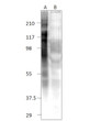 Western blot with Anti-TTC27 Antibody (STJ503432) on A) TTC27 cDNA, B) mCherry control fish. Antibody at 1:500 dilution in buffer.