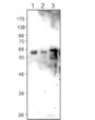 Western blot with Anti-NAMPT Antibody (STJ503510) on 1) Rat cerebral cortex, 2) Rat hippocampus, 3) Rat heart. Antibody at 1:500 dilution in buffer.