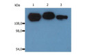 Anti-CD29 antibody [MEM-101A] (STJ16100040)