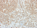 Anti-CD20 antibody [MEM-97] (STJ16100060)