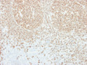 Anti-CD20 antibody [MEM-97] (STJ16100060)