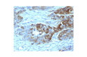 Anti-H type 2 antibody [19-OLE] (STJ16100156)