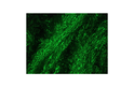 Anti-Neurofilament antibody [RNF403] (STJ16100223)