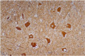 Anti-Neurofilament antibody [NF-01] (STJ16100237)
