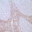 Anti-bcl-2 antibody [E17] (STJ16100312)