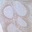 Anti-bcl-2 antibody [E17] (STJ16100312)