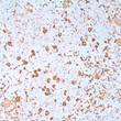 Anti-Fascin antibody [55-k2] (STJ16100367)