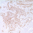 Anti-NGFR antibody [MRQ-21] (STJ16100403)