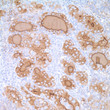 Anti-Thyroglobulin antibody [MRQ-41] (STJ16100431)