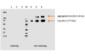 Anti-Transferrin antibody [HTF-14] (STJ16100593)