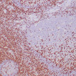 Formalin-fixed, paraffin-embedded human tonsil stained with anti-CD2 antibody using peroxidase-conjugate and DAB chromogen. Note membrane and cytoplasmic staining of perifollicular T cells