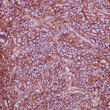 Anti-CD44 antibody IHC human squamous cell carcinoma STJ180496