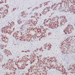 Anti-ER antibody IHC breast carcinoma STJ180511
