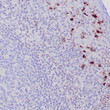Anti-TRAcP antibody IHC human tonsil STJ180545