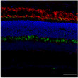Immunostaining- C57BL/6J mouse retina labeled with:Green-1st antibody Cone Arrestin (1:1,000) ; 2nd antibody goat anti-rat (STJ140235, 1:1,000) , Red-1st antibody Rhodopsin (1:1,000) ; 2nd antibody goat anti-mouse (STJ140232, 1:1,000) , Blue-Nuclear staining (DAPI) , scale bar = 40 um