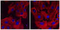 Immunofluorescence using hCEC cells, 1st antibody (anti-beta-Actin at 1/250) and 2nd antibody (anti-mouse STJ140232 at 1:1,000) ; cells were fixed with methanol