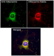 Immunofluorescence –anti-mNectarine antibody using hCEC cells transduced with mNectarine-Rab5a; cells were fixed with methanol and anti-mNectarine at 1/250