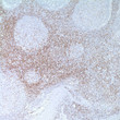 Anti-CD45RO antibody [UCHL-1] (STJ16101489)