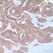 Anti-Cytokeratin, HMW antibody [AE3] (STJ16101513)