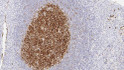 Anti-CD10 antibody [56C6] (STJ16101693)