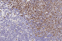 Anti-EZH2 antibody [6A10] (STJ16101739)