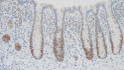 Anti-MSH6 antibody [PU29] (STJ16101771)