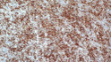 Anti-CD43 antibody [MT1] (STJ16101772)